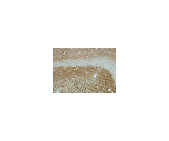 62-8494-88 Anti-Tau-1, clone PC1C6; 100 μg MAB3420