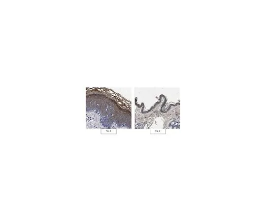 62-8473-37 Anti-Pro-Biglycan Antibody ABT270