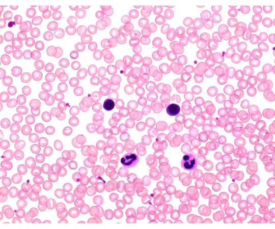 61-0310-65 Hemacolor(R) Solution 2 Red Solution Hemacolor(R) 111956 2.5L 1.11956.2500