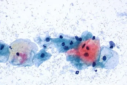 61-0306-65 Papanicolaou Stain Solution 3c, EA65 for Mucus Membrane Cytology. Result Of Cell Cytoplasm Staining: Red Color 109270 100mL 1.09270.0100