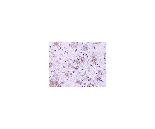 62-8473-76 Anti-KLHL1 ABT341