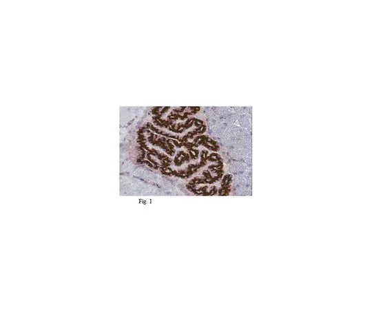 62-8501-25 Anti-Sphingosine 1-phosphate receptor 1 (S1P1), clone 8B7.1 MABC94