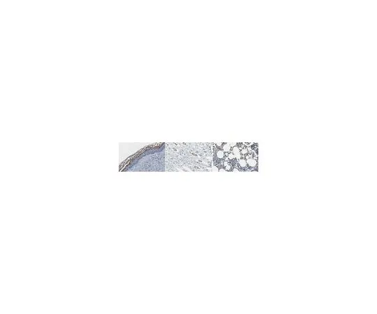 62-8503-48 Anti-Kallikrein 7/KLK7 Antibody, clone 73-1 MABC967