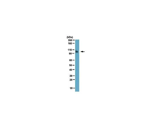 62-8472-22 Anti-Fibroblast activation protein alpha (FAP); 100 μg ABT11