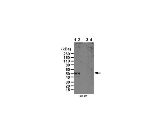 62-8472-45 Anti-phospho PKA-RII (Ser96); 100 μL ABT58