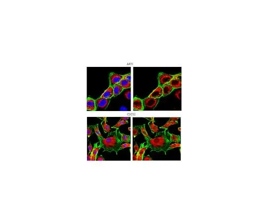 62-8469-08 Anti-MAPK 1/2; 100 μg ABS44