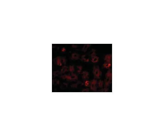 62-8471-06 Anti-NOTUM ABS762