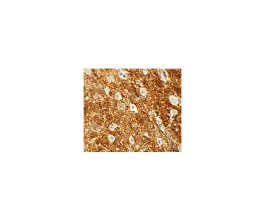 62-8469-99 Anti-ROCK2 ABS436