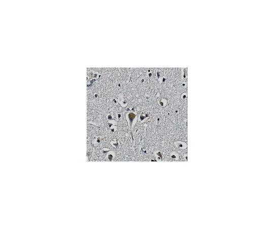 62-8517-59 Anti-KChIP2 potassium channel subunit Antibody, clone 60/73 Cat. No. MABN371 MABN371