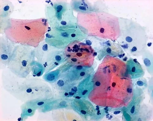 61-0301-75 Papanicolaou Stain Solution 2A, OG-6 for Papanicolaou Stain 106888 2.5L 1.06888.2500