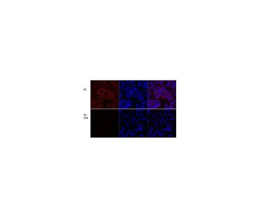 62-8472-11 Anti-PDH ABS2082