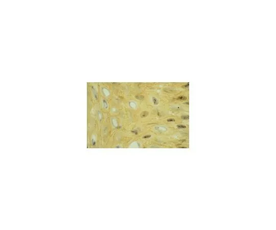 62-8479-89 Anti-Integrin alphaV, clone 13C2; 100 μg CBL490
