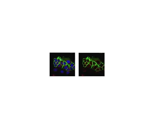62-8479-53 Anti-Epithelial Specific Antigen, clone VU-1D9; 100 μg CBL251