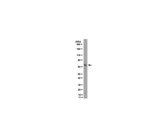 62-8502-14 Anti-BIRC2/IAP-2, clone 1E1-1-10 MABC535 MABC535