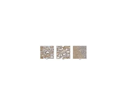 62-8472-88 Anti-L1CAM ABT143