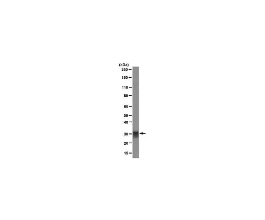62-8490-55 Anti-Tryptase, Mast Cell, clone G3; 100 μg MAB1222