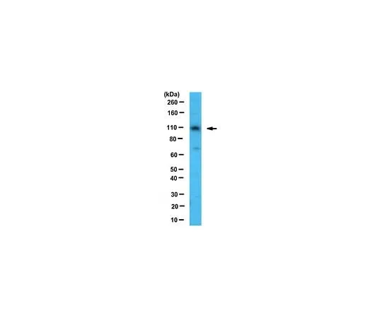 62-8471-17 Anti-E6AP ABS989