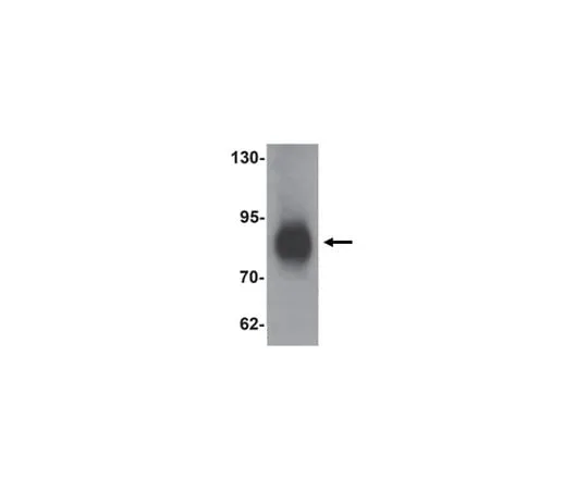 62-8473-87 Anti-LRRFIP1 ABT406