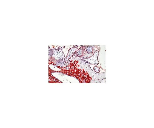 62-8500-34 Anti-MMP-2, pro and active form, clone A-Gel VC2; 500 μL MAB13431