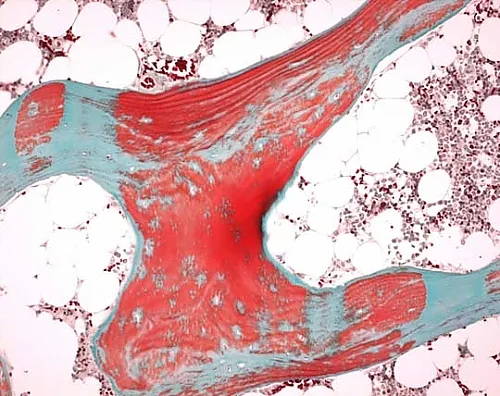 61-0290-50　OSTEOSOFT(R) Mild Decalcifier Solution for Histology 101728 10L　1.01728.9010