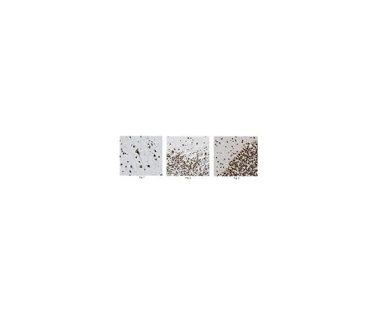 62-8516-47 Anti-Tdp43, clone 3H8 MABN45