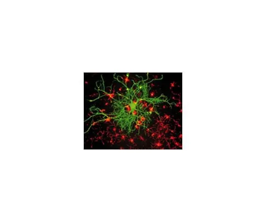 62-8491-49 Anti-Neurofilament 70 kDa, clone DA2; 300 μL MAB1615