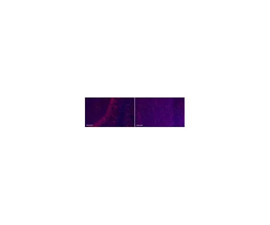 62-8494-89 Anti-Tau Antibody, clone PC1C6, Alexa Fluor(R) 555 Conjugate MAB3420-AF555