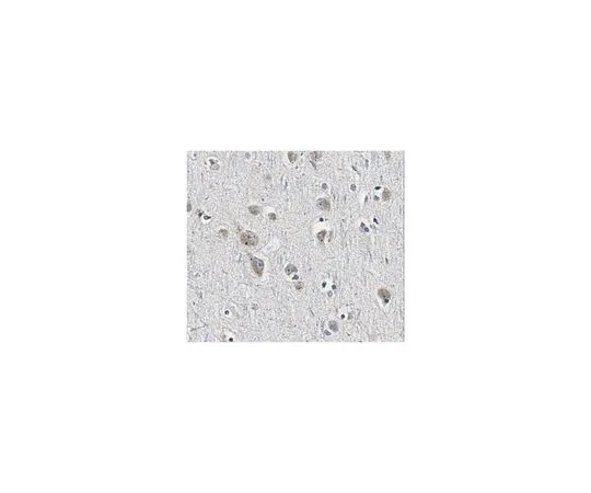 62-8521-28 Anti-Sortilin Antibody, clone F11 MABN1792