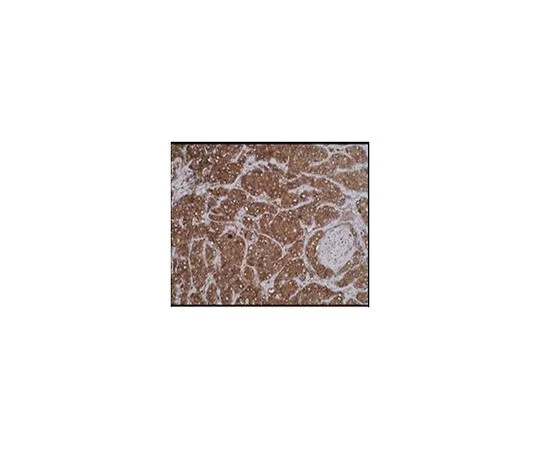 62-8517-62 Anti-Alanyl-tRNA synthetase (AARS), clone M6-P2E5 MABN376