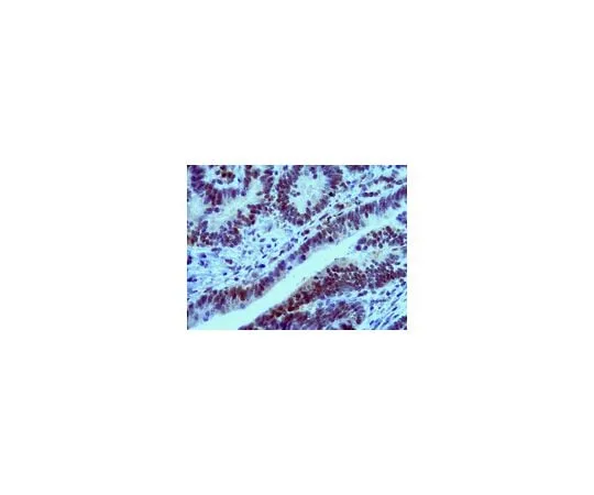 62-8469-35 Anti-MLK1; 100 μg ABS94