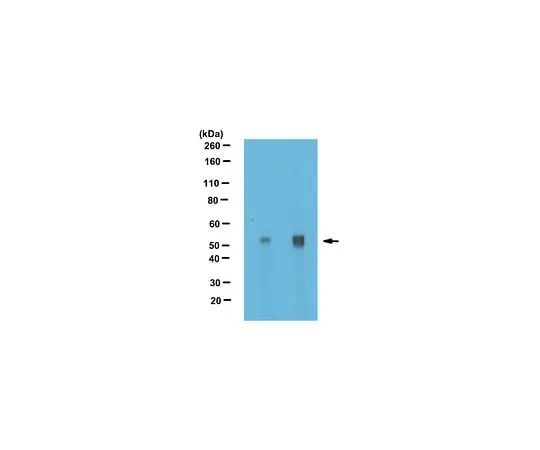 62-8473-08 Anti-alpha Tubulin Antibody, nontyrosinated Cat. No. ABT170 ABT170