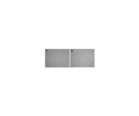 62-8531-81 Human Adipose Mesenchymal Stem Cells SCC038