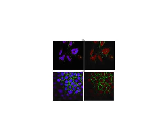 62-8501-51 Anti-BRCA1, clone MS13 MABC161