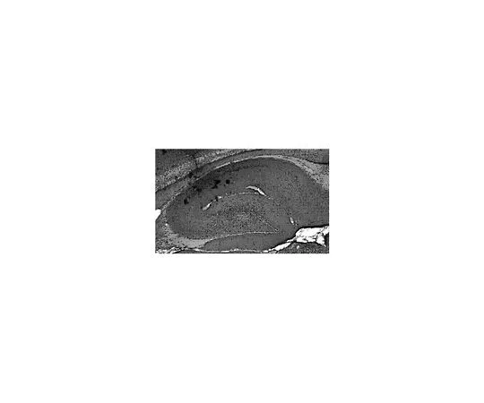 62-8516-44 Anti-Sodium channel Nav1.7, clone N68/6; 100 μg MABN41