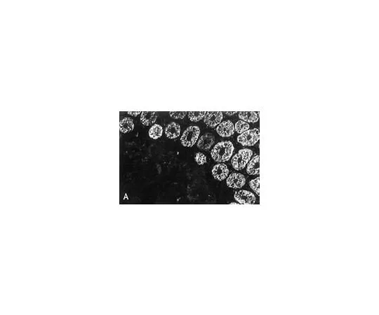 62-8494-55 Anti-Cytokeratin 18, clone RCK106; 100 μg MAB3236