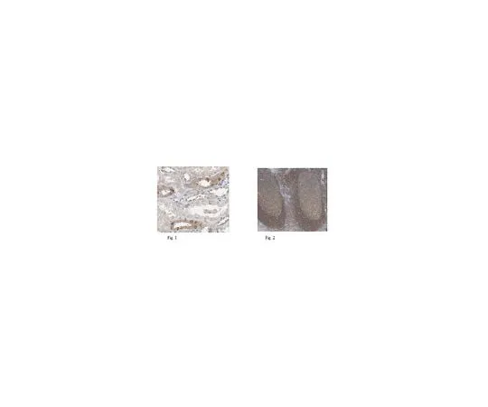 62-8509-28 Anti-IKKa (p45), clone 881H3 MABF222