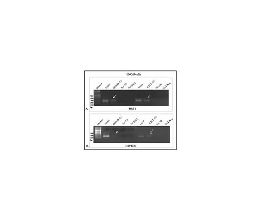 62-8508-57 Anti-BORIS/CTCFL Antibody, clone 4A7 MABE1125