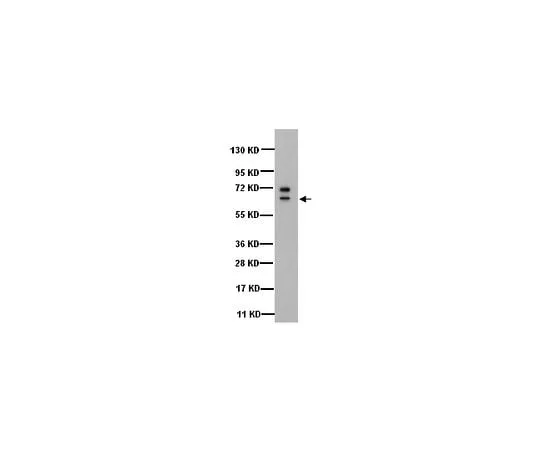 62-8491-55 Anti-Cytokeratin 5, 6, clone D5/16B4; 50 μg MAB1620