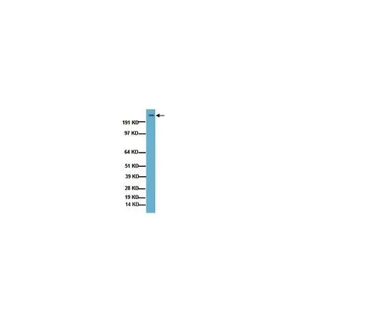 62-8493-39 Anti-Huntingtin Protein, a.a. 181-810, clone 1HU-4C8; 100 μL MAB2166