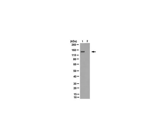 62-8519-79 Anti-polyQ Disease Proteins Antibody, clone 3B5H10 MABN821