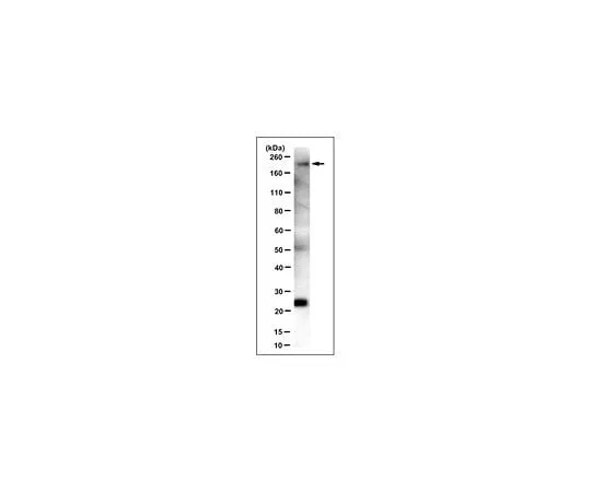 62-8492-17 Anti-Laminin γ1 Antibody, clone 2E8 (Ascites Free) MAB1920-C