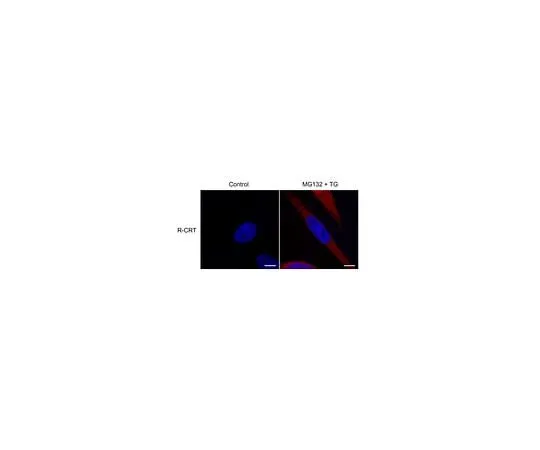62-8472-01 Anti-Calreticulin Antibody, arginylated (Nt-Glu18) ABS1671