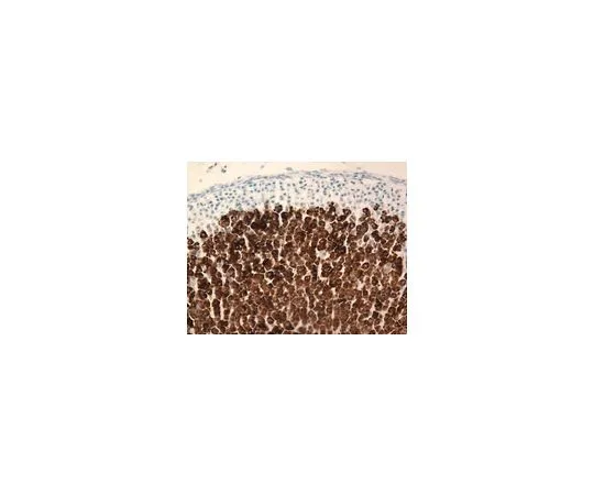 62-8498-57 Anti-Cytochrome P450 11beta-Hydroxyllase, clone 11B2-1A4; 500 μL MAB6020