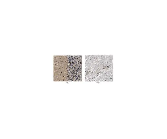 62-8517-60 Anti-CLN3, Clone 2B8.2 MABN372
