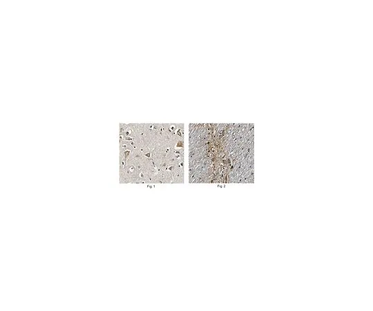 62-8516-63 Anti-CORO1A, clone 2E11.2 MABN85