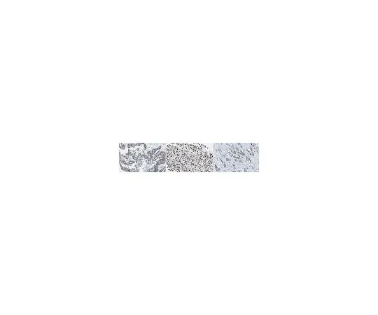 62-8508-44 Anti-SMARCA3 (HLTF), clone 5-1 MABE1107