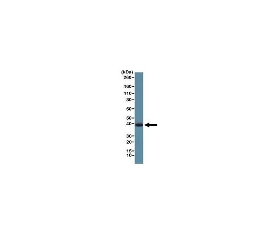 62-8523-72 Anti-GAPDH (CT) Antibody, clone RM114 MABS819