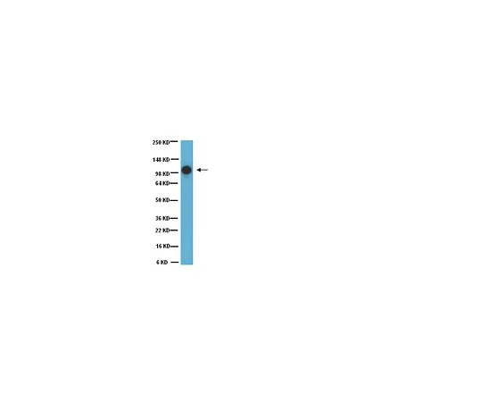 62-8500-49 Anti-MCAM, clone P1H12; 100 μg MAB16985