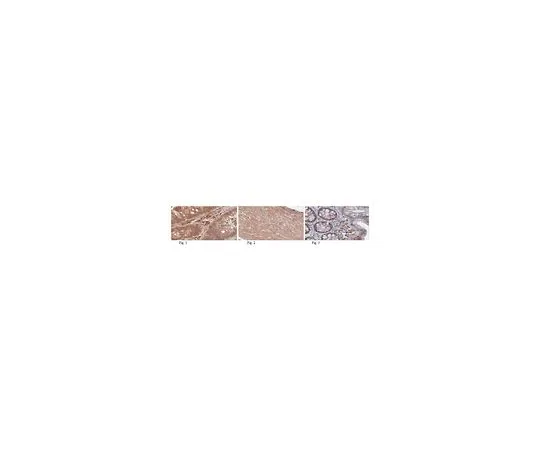 62-8501-74 Anti-APC, clone CC-1 MABC200