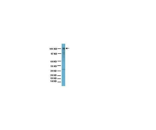 62-8494-83 Anti-MAP2, clone AP20; 200 μg MAB3418